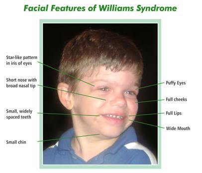 Discovering the Unique World of Williams&nbsp;Syndrome