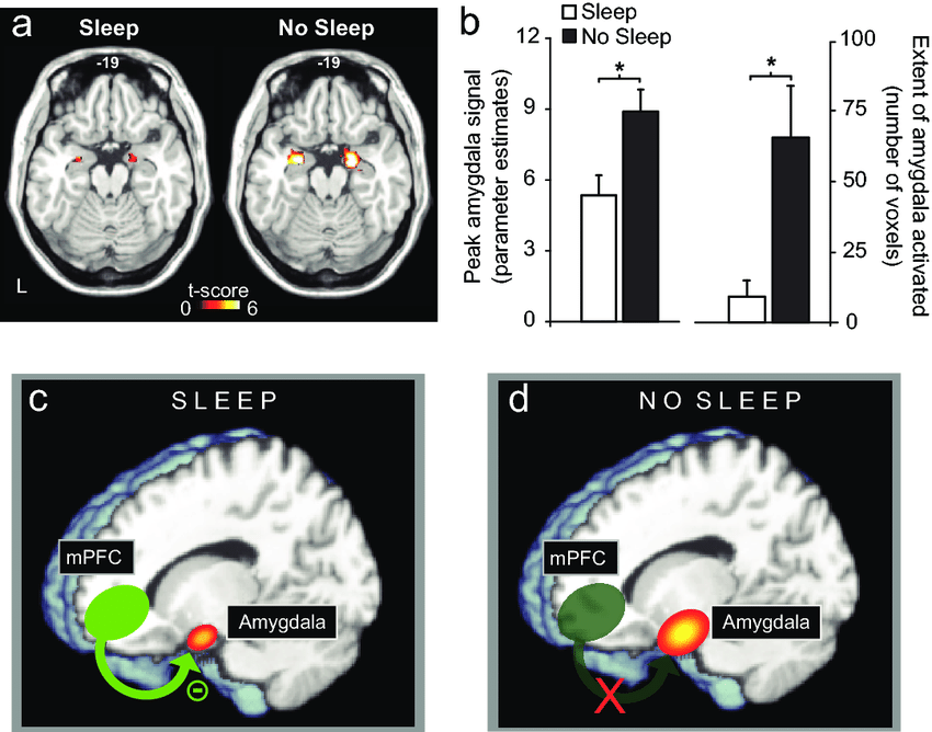 “The Sleep-Brain Connection: Unlocking the Potential of Alternative Education”