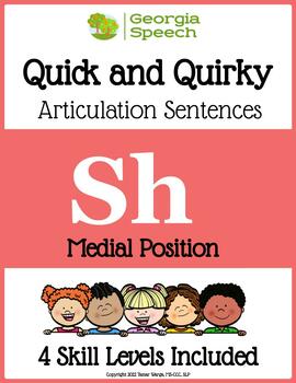 Embracing the Quirky Side of Learning: Individualized Assessments Unleash Students’ Potential