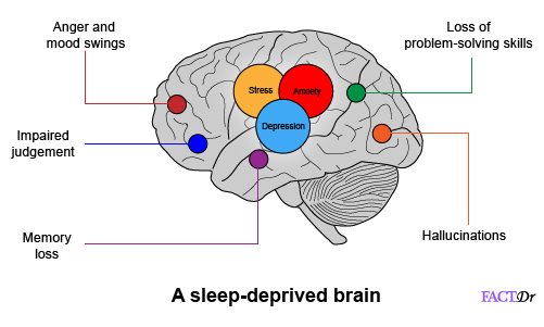 The Impact of Sleep Deprivation on Brain Function: Uncovering the Detrimental&nbsp;Effects